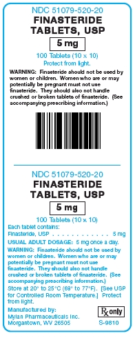 Finasteride Tablets, USP 5 mg