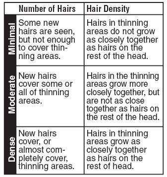 What minimal, moderate and dense hair regrowth will mean for you chart image
