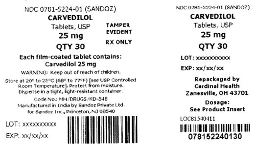 Carvedilol 25 mg Carton