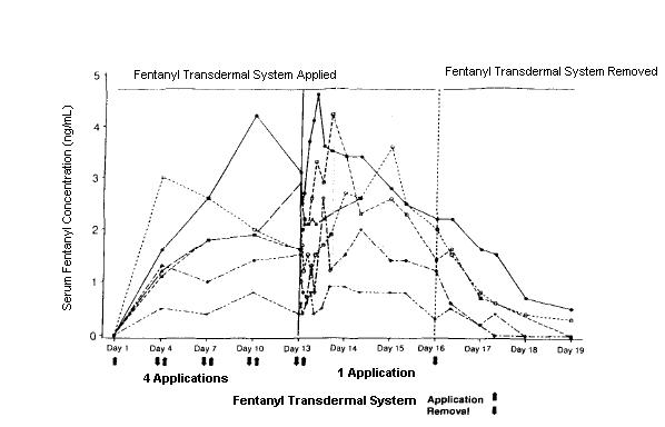 Fentanyl Transdermal System Applied