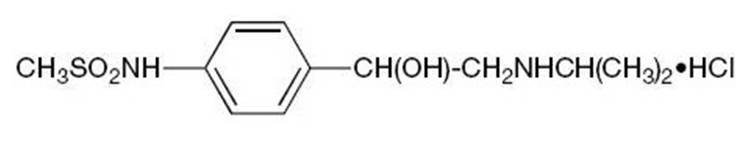 Chemical Structure-Sotalol Hydrochloride