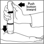 Figure 6 - Push button inward