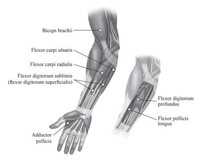 Figure 2: Injection Sites for Upper Limb Spasticity