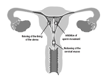 Uterus graphic
