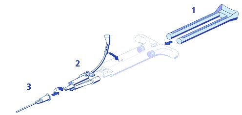 DUO set indicating syringe barrel, 2 syringe nozzles with joining piece and application cannula