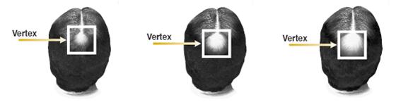 Vertex Image
