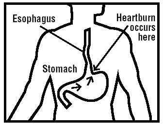 Esophagus/Stomach image