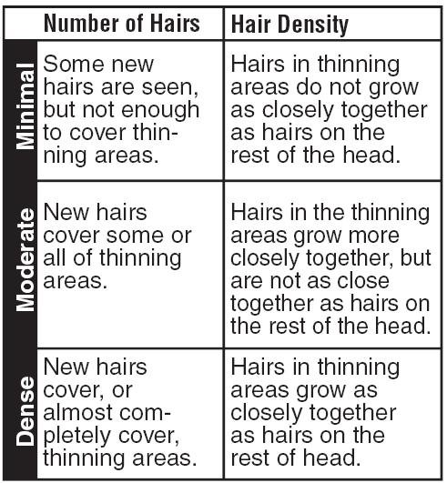 What Minimial, Moderate and Dense Hair Regrowth will mean for you chart