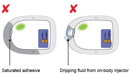 What to do if the adhesive becomes saturated with fluid or the on body injector is dripping.