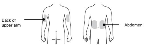 On-body Injector Placement 