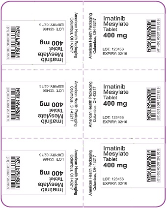 400 mg Imatinib Mesylate Tablet Blister