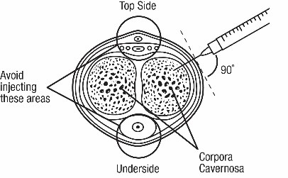 Top side