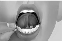 bupr-naloxone-ifu-mouth-image