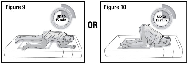 Figure 9 and Figure 10