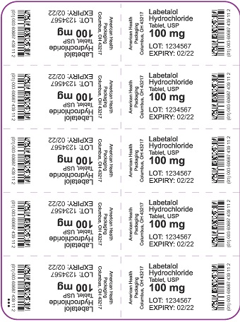 100 mg Labetalol Hydrochloride Tablet Blister