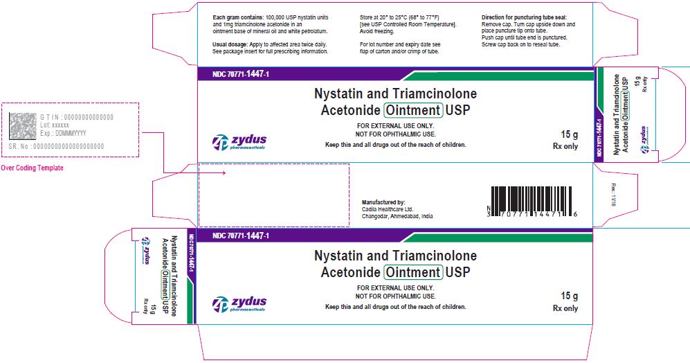 Nystatin and Triamcinolone Acetonide Ointment