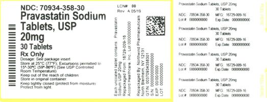 Pravastatin Sodium by Denton Pharma, Inc. Dba Northwind Pharmaceuticals 30 In 1 Bottle Breastfeeding