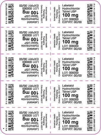 100 mg Labetalol HCl Tablet Blister