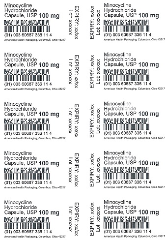 100 mg Minocycline HCI Capsules Blister