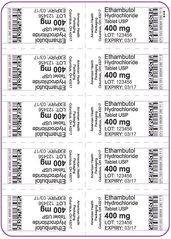400 mg Ethambutol Hydrochloride Tablet Blister