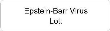 Epstein-Barr Virus Kit vial