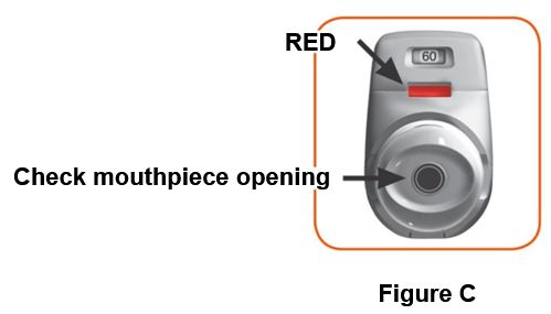 Figure C - RED - Check mouthpiece opening