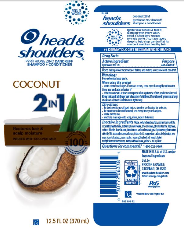 Head And Shoulders Coconut 2in1 | Pyrithione Zinc Shampoo while Breastfeeding
