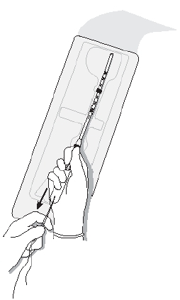 Figure 2a. Loading Mirena into the insertion tube