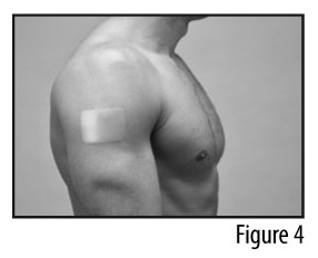 Figure 4 - Patch applied to shoulder