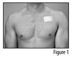 Figure 1 - Patch applied to chest