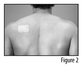 Figure 2 - Patch applied to back