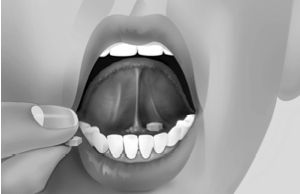 Tablets under tongue illustration
