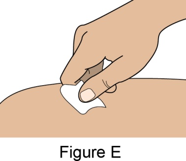 Figure E
