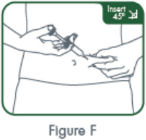 Figure F