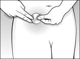 Peel off the second side of the protective liner. Put the sticky side of the patch on the lower abdomen (below the panty line).