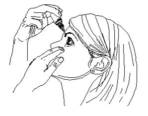 Step 5. Turn your dorzolamide hydrochloride ophthalmic solution dispenser upside down and squeeze lightly with the thumb or index finger (as shown) until a single drop is placed in your eye. Do not touch your eye or eyelid with the dropper tip. See Figure E.