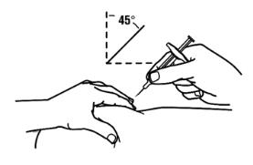4.	With a quick and “dart like” motion, insert the needle at a 45 degree angle into the skin.