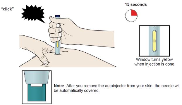 Keep pushing down on your skin. Your injection could take about 15 seconds. You may hear or feel a second click when the injection completes.