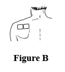 Figure B