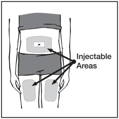 Title: Injectable Areas