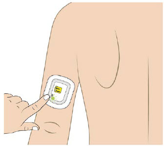 image 16 - UDENYCA ONBODY injector - OBI healthcare provider instructions for use