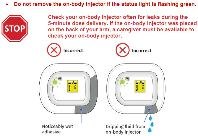 iimage 6 - UDENYCA ONBODY injector - OBI paitent instructions for use