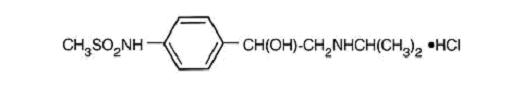 Structural formula for sotalol hydrochloride