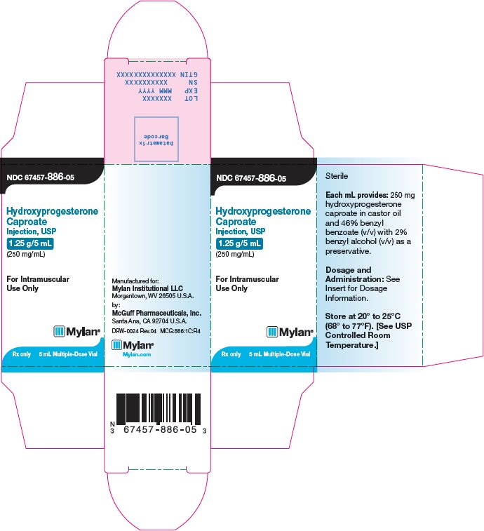 Hydroxyprogesterone Caproate Injection, USP 1.25 g/5 mL Carton