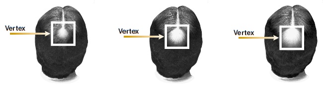 Vertex Image
