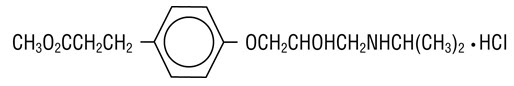 Esmolol hydrochloride Structural Formula