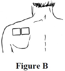 figure-b.jpg