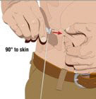 Remove the needle cover.  Firmly grasp skin and pinch at least one inch of skin between two fingers.   Insert needle with a rapid motion straight into the skin at a 90 degree angle.  Tape the needle in place. Repeat this step for each infusion site.