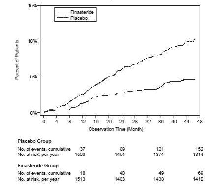 Figure 2 Percent of Patients Having Surgery for BPH, Including TURP