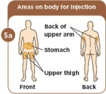 injection site